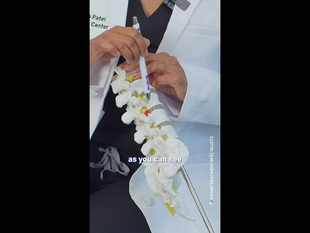 Understand the back's anatomy!