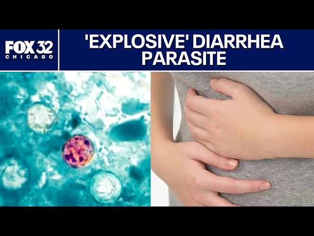 Illinois doctor explains what to know about the 'explosive' diarrhea parasite