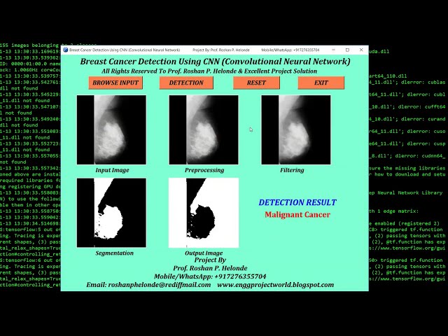 Breast Cancer Detection Using CNN Python Opencv | Breast Cancer Classification Using Python Project