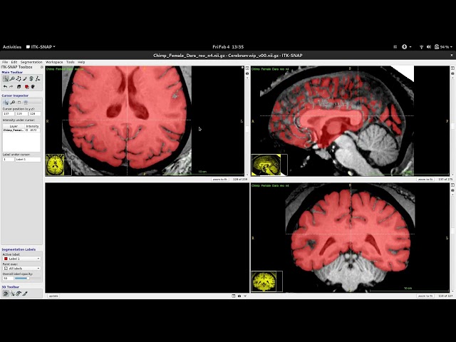 Tutorial - Cutting a chimpanzee brain stem in ITKSNAP