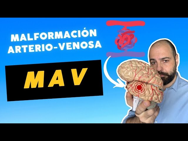 MAV una maraña en el cerebro