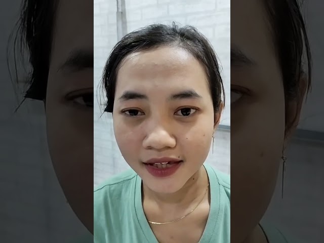 TREATMENT FOR FACIAL NERVE TWISTING, EYE AND LIPS TWISTING, HEMIFACIAL SPASM, FACIAL TIC.