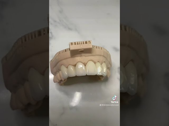 How ceramic veneers are made in our lab! #shorts