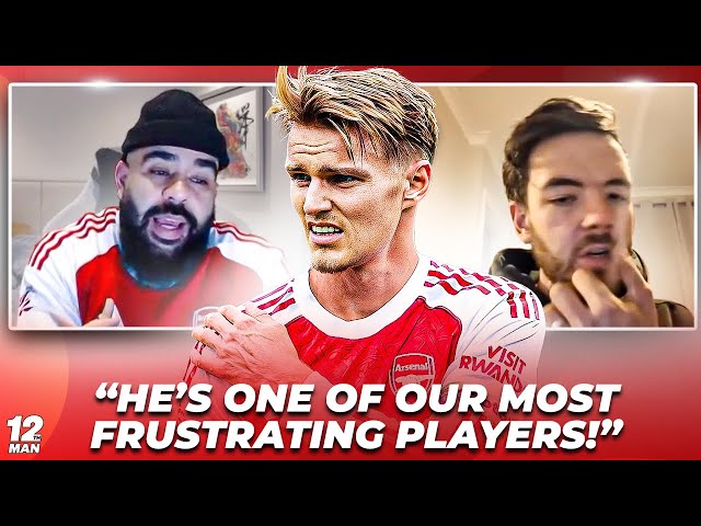 😬🔥 BRUTAL TRUTH ABOUT ODEGAARD! 🔥😬