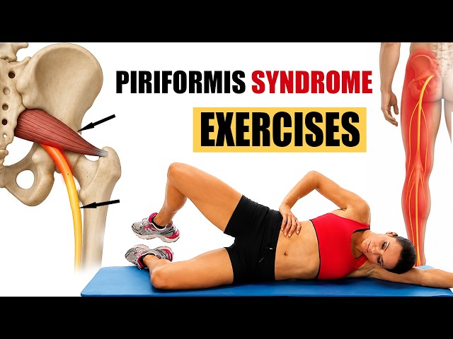 Piriformis Syndrome Exercises