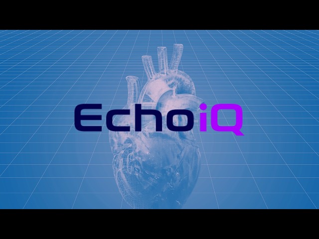 Stock of the day: Echo IQ (EIQ)
