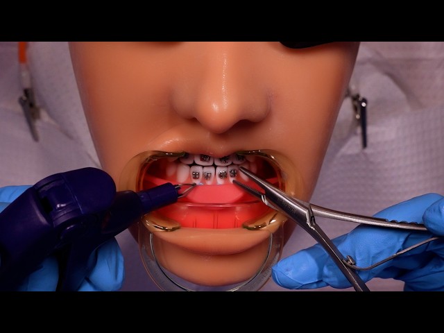 ASMR Orthodontist Gives You Braces | Medical Roleplay