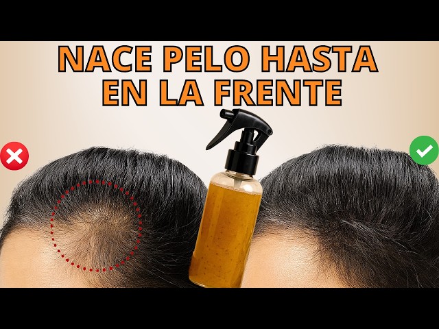 GROW YOUR HAIR IN DAYS WITH 1 NATURAL INGREDIENT THAT EVERYONE THROWS AWAY😱 (THIS IS GOLD FOR YOU...