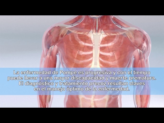 Vídeo diagnóstico Enfermedad de Pompe