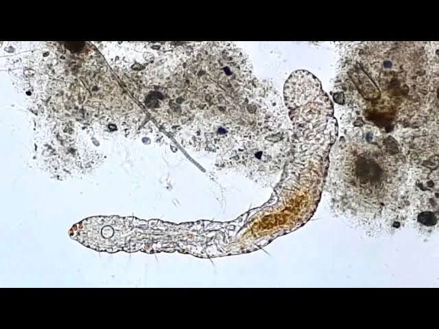Water Flea, worms and more. Look 👀what’s under my microscope 🔬 
