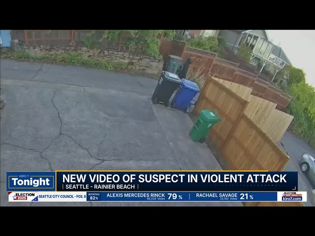 Surveillance footage shows man running after biting woman's finger off during robbery