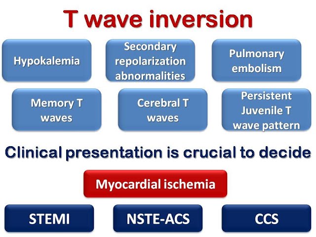 ECG course: T wave inversion, Dr. Sherif Altoukhy