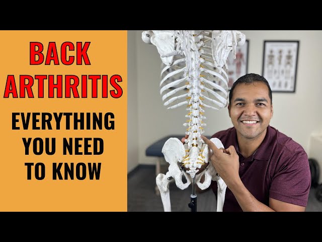 Back Arthritis: Everything You Need To Know To Understand And Fix The Root Problem