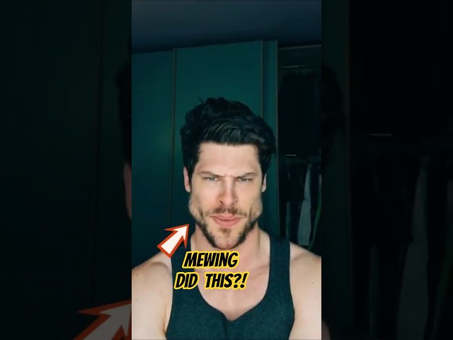 Mewing: The Internet's Jawline Hack!