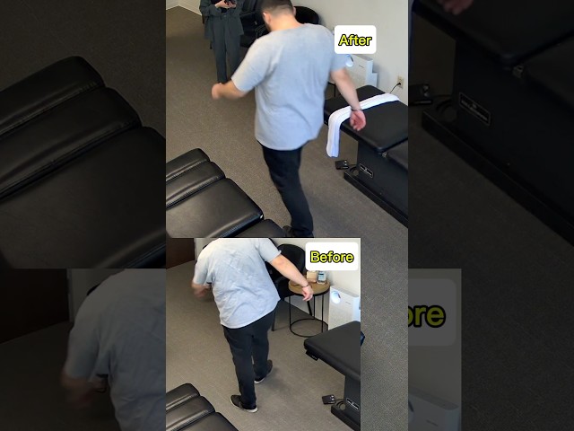 Intense Ring Dinger® treatment