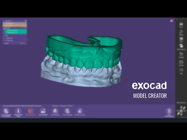 Exocad Printable Model