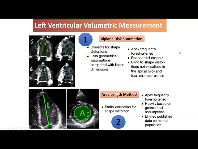 Quantification of Left heart by Echocardiography ASE