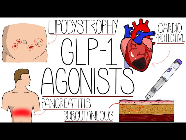 Understanding GLP-1 Agonists