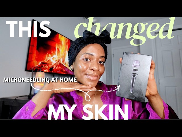 HOW I MICRONEEDLE MY SKIN AT HOME  #athomemicroneedling #microneedlingbeforeandafter