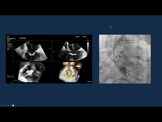 Dr. Gilbert Tang's Tips and Tricks on Optimizing Powerpoint (PPTX) Presentations