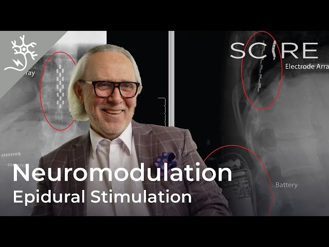 Epidural Stimulation After Spinal Cord Injury: Restoration of Motor and Autonomic Function