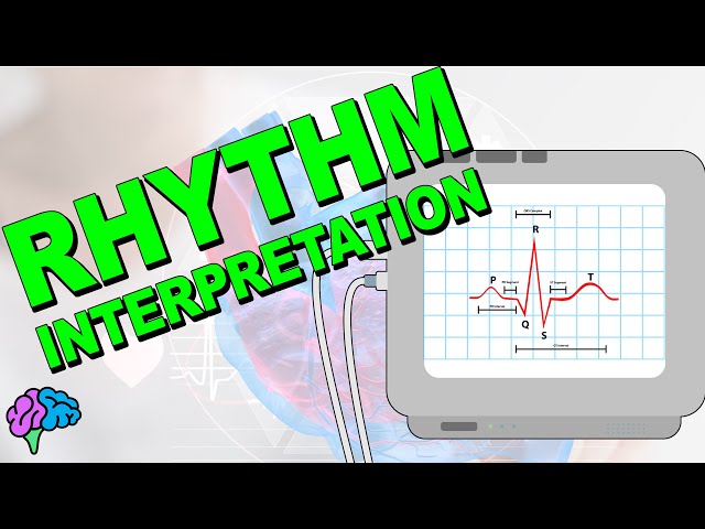 The Complete ECG Rhythm Interpretation Series!
