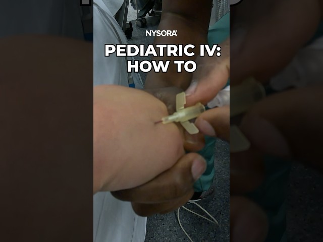Pediatric IV: How to #iv #insertion #pediatric #technique #intravenousinjection