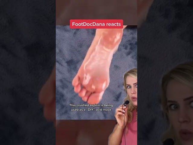 Doctor reacts: bizarre callus hacks