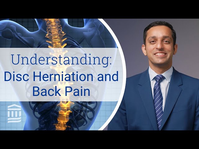 Disc Herniation: Symptoms, Treatment, Risk Factors & Causes | Mass General Brigham