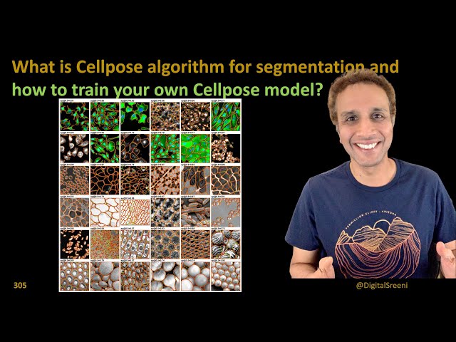 305 - What is Cellpose algorithm for segmentation?