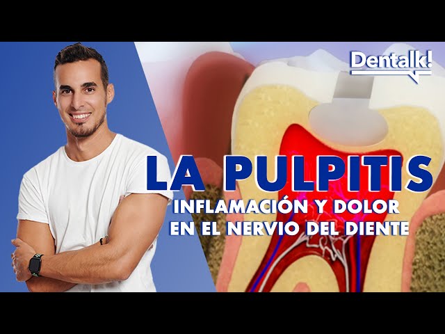 TOOTHACHE? It could be PULPITIS - Dental NERVE INFLAMMATION treatment | Dentalk! ©