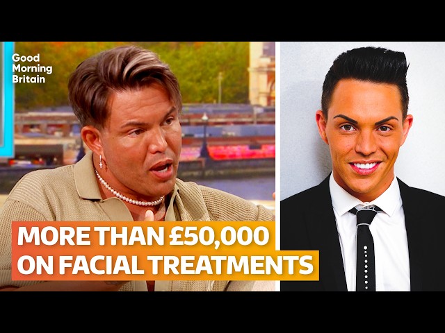 TOWIE star opens up about £50k cosmetic journey and latest facelift