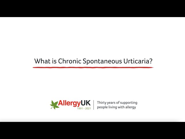 What is Chronic Spontaneous Urticaria?