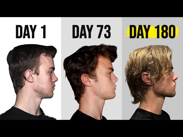 I Spent 180 Days Fixing my Side Profile, Here’s What I Did