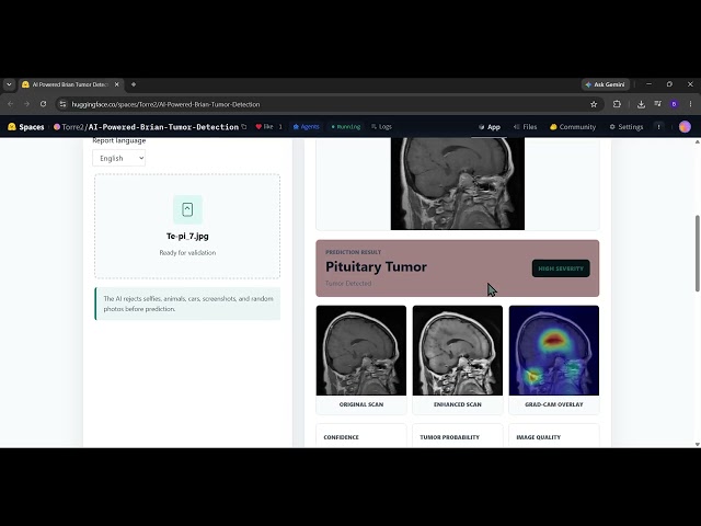 AI-Powered Brain Tumor Detection using Deep Learning