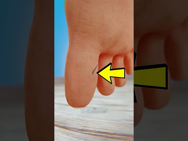 How to Remove a Splinter Without Pain (Easy Method)