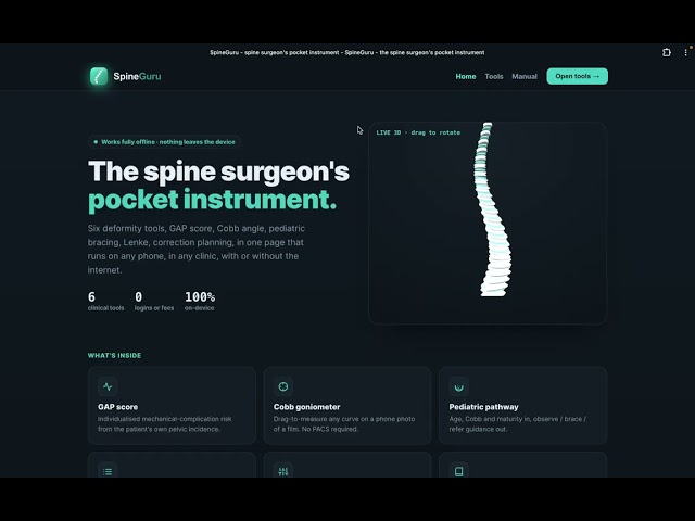 SpineGuru: An AI-Assisted Spine Surgery Decision-Support Prototype (Offline, No Login)