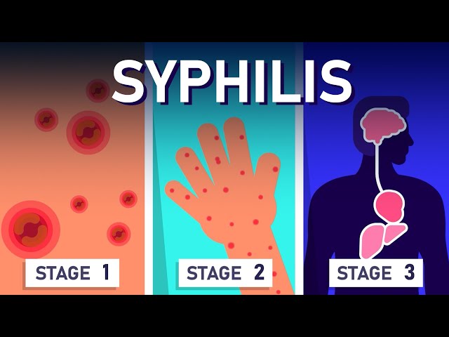 STD: Symptoms, Transmission, and Prevention