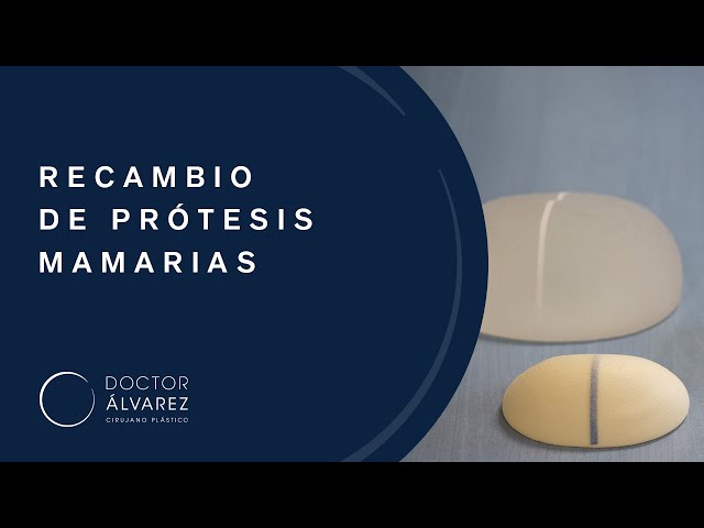 Recambio de prótesis mamarias | DOCTOR RUBÉN ÁLVAREZ