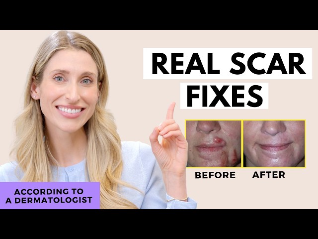 Fade Scars FAST (and for real) | Dr. Sam Ellis