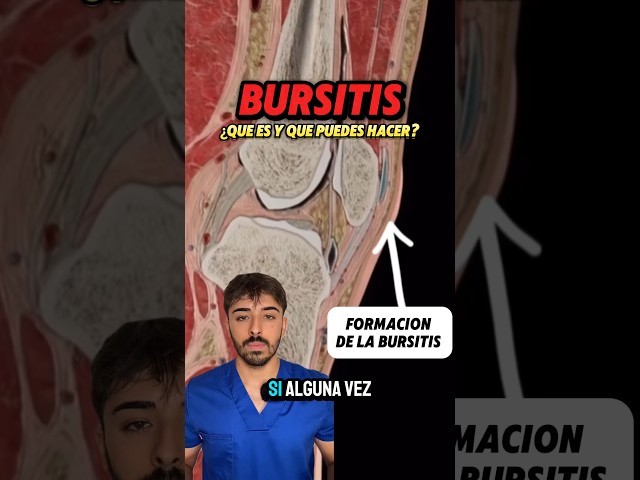 ❗️¿QUE ES LA BURSITIS?❗️En instagram todo #dolor #codo #hombro #rodilla #doctor #fisio #anatomia