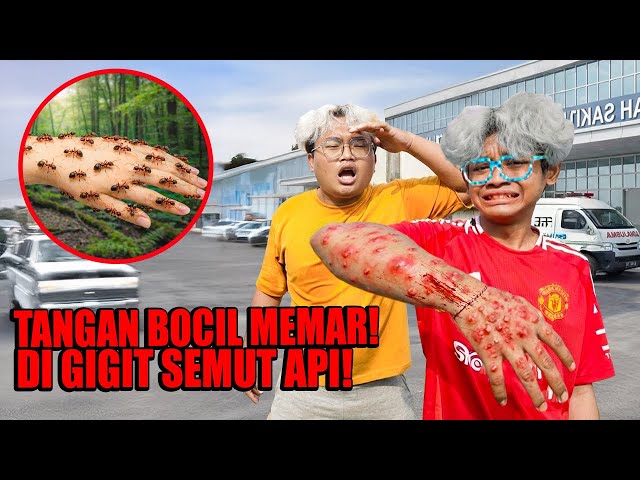 KASIHAN BOCIL SAMPAI NANGIS!!! TANGAN NYA DIGIGIT SEMUT MERAH SAMPAI MEMAR - MEMAR BEGINI!