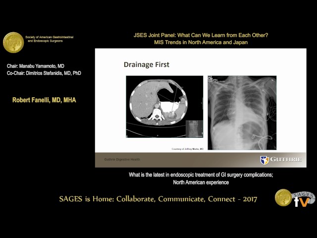Endoscopic management of complications associated with GI surgery