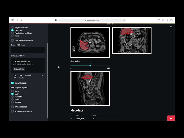 AI Automatic Organ Segmentation and 3D visualisation Web App