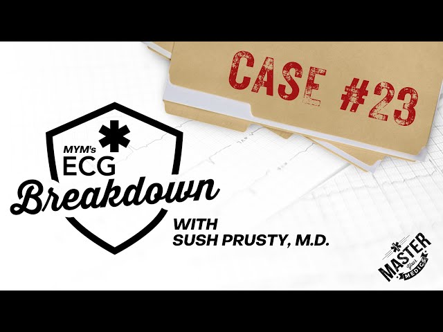 Case #23 | ECG Breakdown