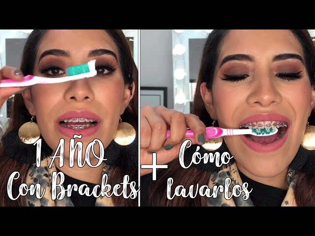 Mi experiencia con brackets 5 +CÓMO LIMPIARLOS | Carel Quezada