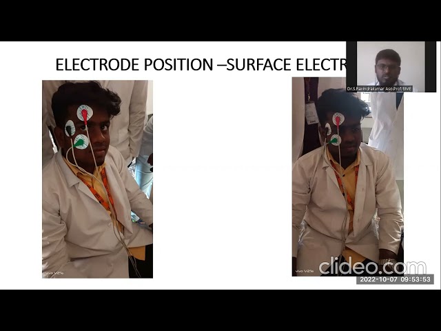 electrooculogram (EOG) -BIOMEDICAL INSTRUMENTATION