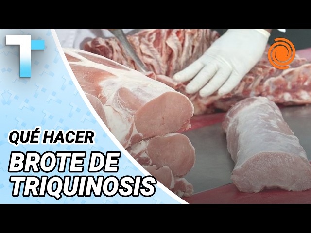 TRICHINOSIS OUTBREAK in Córdoba: 30 confirmed cases, symptoms, and how to prevent it