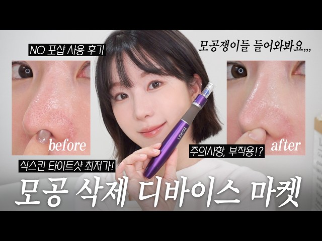 I brought a device that removes pores.... Sixkin Tight Shot Auto MTS Lowest Price Market🔥 (Pore r...