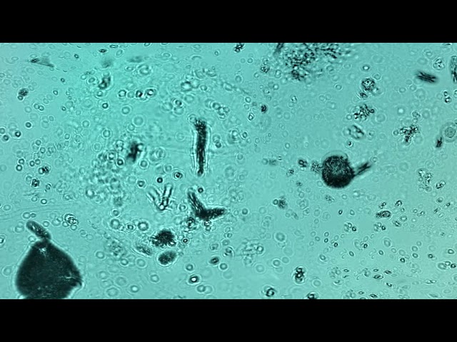 Swimming with Plankton: 360